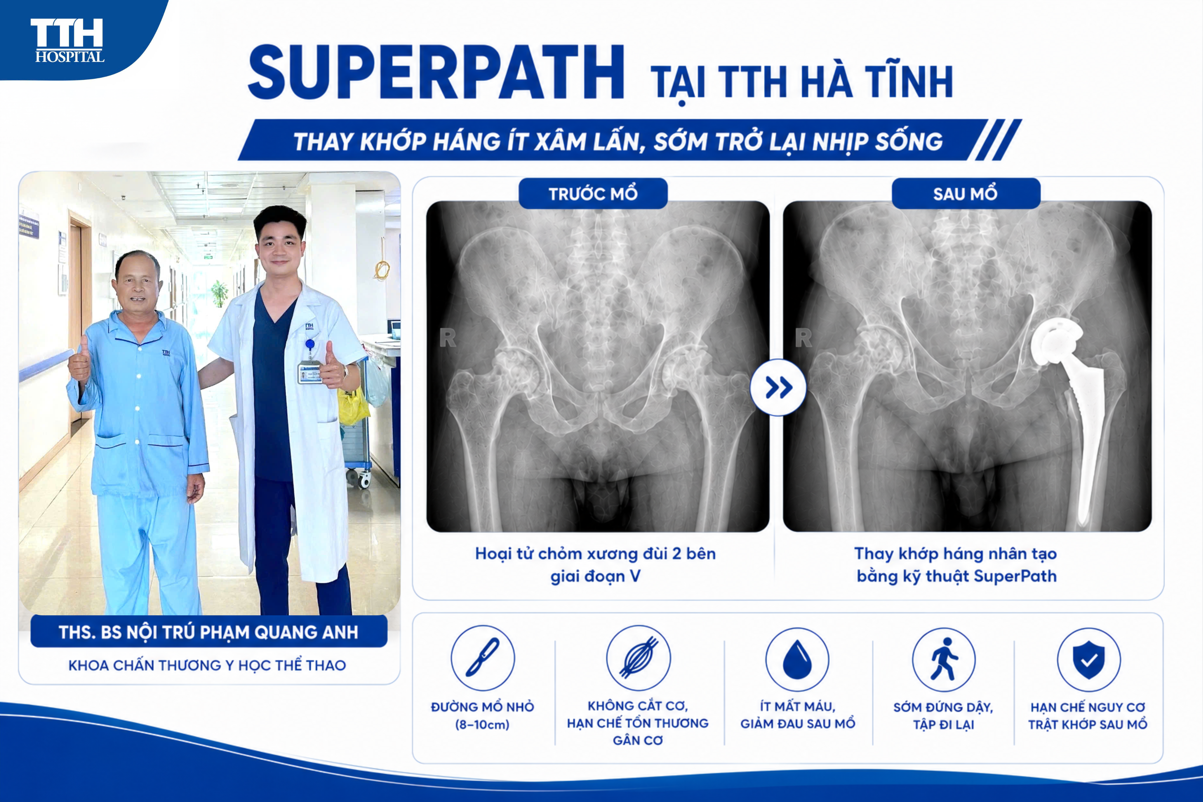 SUPERPATH TẠI TTH HÀ TĨNH – THAY KHỚP HÁNG ÍT XÂM LẤN, SỚM TRỞ LẠI NHỊP SỐNG